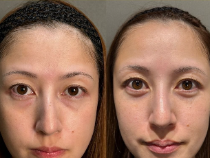 石川 様の使用前後の比較