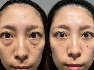 村上 様の使用前後の比較